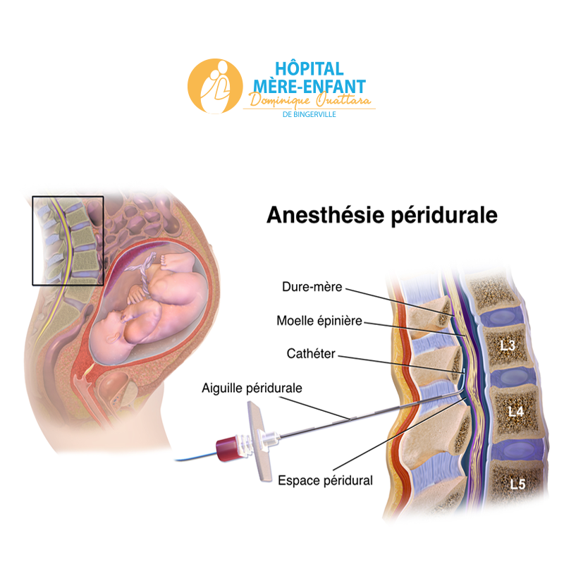 La péridurale en 10 questions